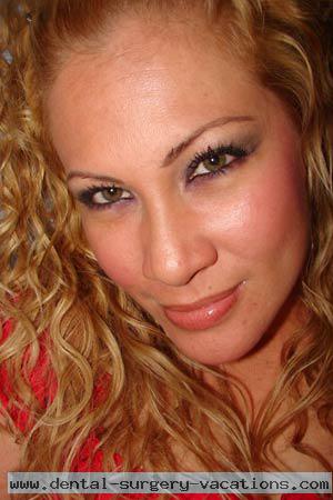 Costa Rica women